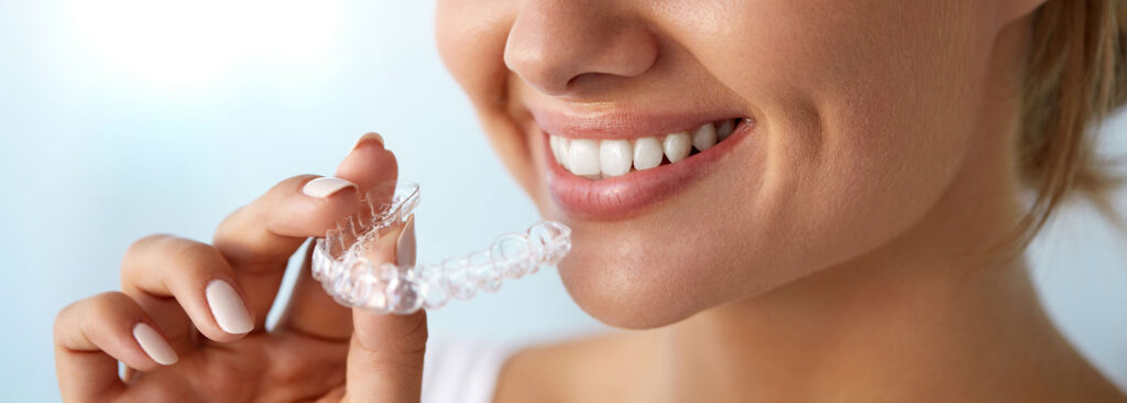 invisalign braces Vaughan